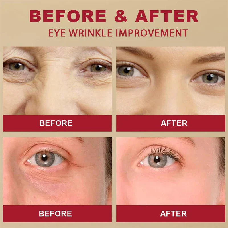 Seoul 1988 Bright Eyes Cream – Dark Circle & Wrinkle Repair & Anti-Aging Hydrating | Korean Formula